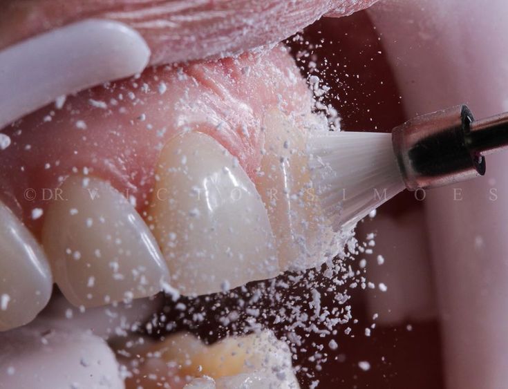 Foto 3 de Dra. Alice Chaves - Dentista