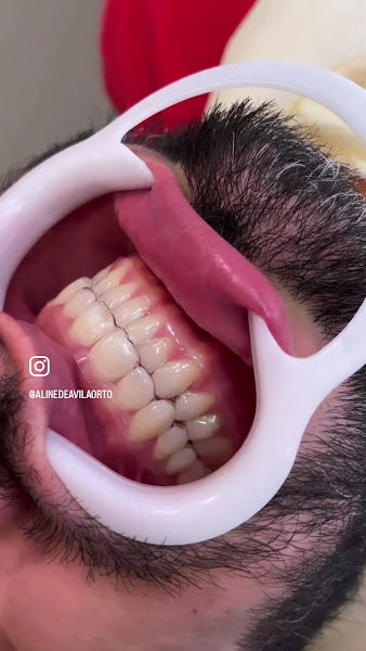 Foto 3 de Dra Aline de Avila - Dentista em Curitiba | CRO-PR 26.534