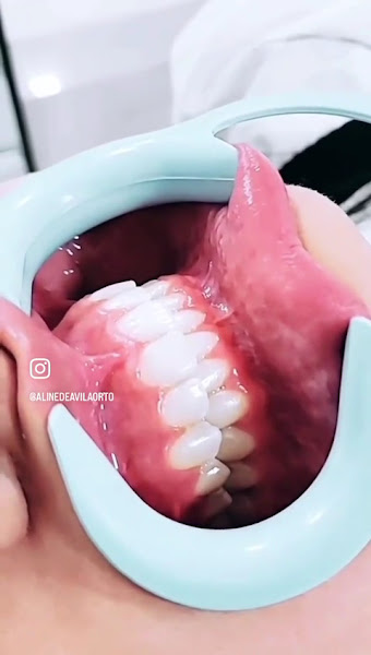 Foto 4 de Dra Aline de Avila - Dentista em Curitiba | CRO-PR 26.534