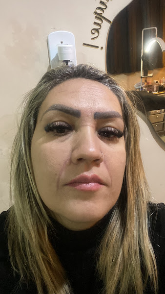 Foto 3 de Dra. Aline Farias - Preenchimentos Corporal e Facial