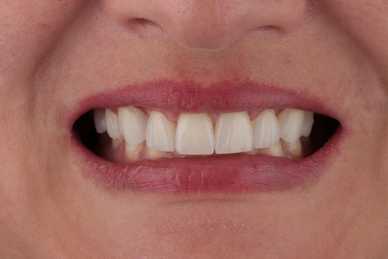 Foto 2 de Dra. Aline Moraes Odontologia Estética e Reabilitadora