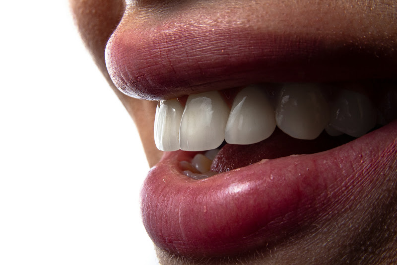 Foto 2 de Dra. Aline Oliveira - Cirurgiã Dentista, Ortodontia e Aparelhos Invisíveis em Botucatu.