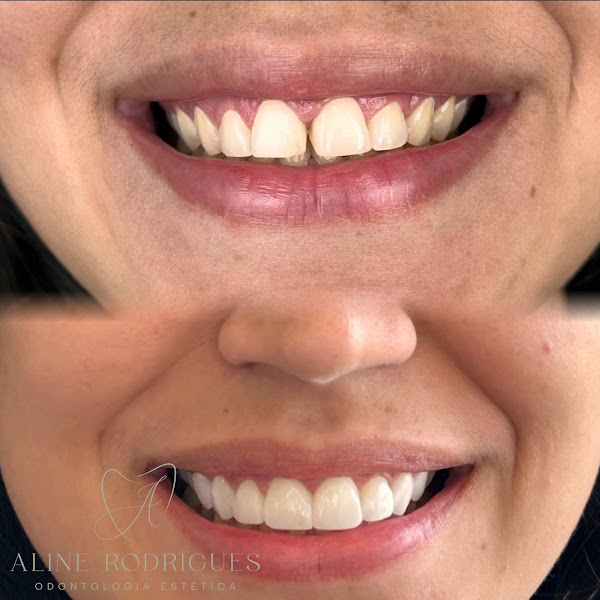Foto 3 de Dra. Aline Rodrigues - Odontologia Estética