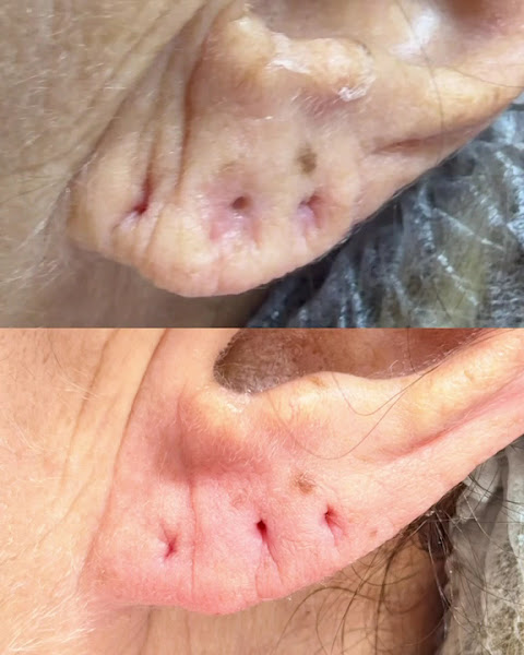 Foto 3 de Dra Aline Rossi - Harmonização Facial, Glútea e Tricologia