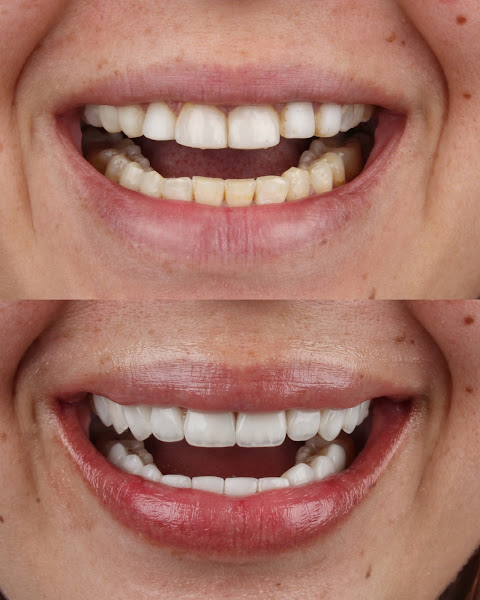 Foto 2 de Dra. Alini Caprini - Cirurgiã Dentista