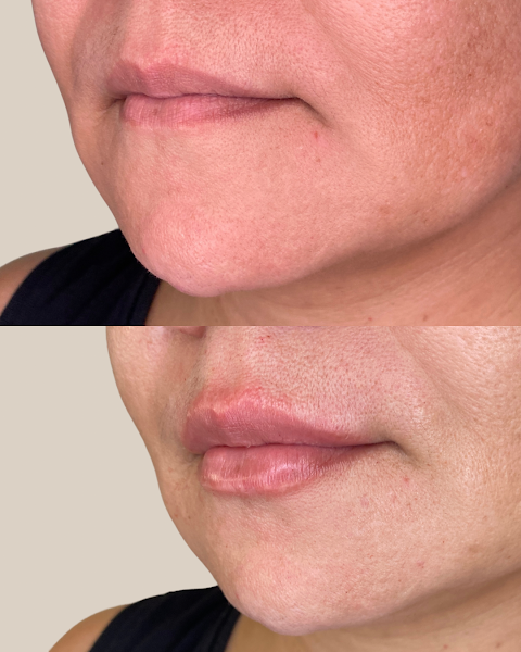 Foto 2 de Dra. Amanda Antunes | Harmonização Facial e Odontologia