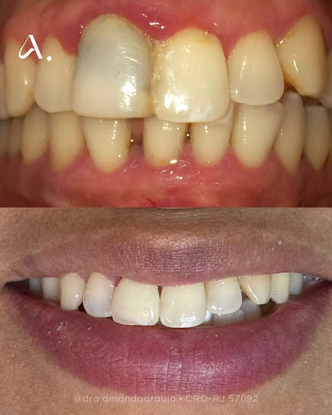 Foto 3 de Dra. Amanda Araujo • Dentista em Campos, RJ