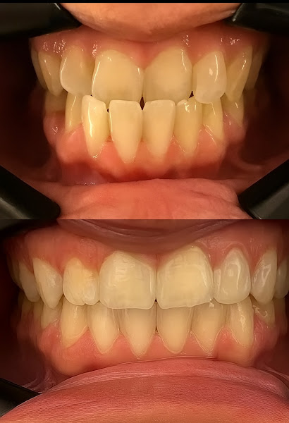 Foto 3 de Dra Amanda Boldrin Odontologia Integrada e Alinhadores invisíveis