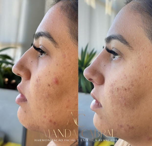 Foto 3 de Dra. Amanda Cabral | Harmonização Facial e Estética Avançada