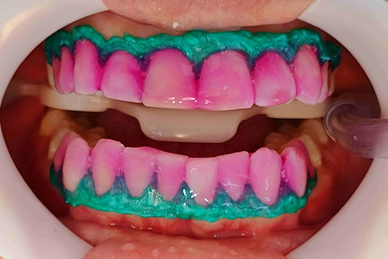 Foto 3 de Dra Amanda Carvalho Cirurgiã-Dentista