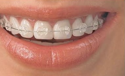 Foto 3 de Dra. Amanda Corocher Odontologia Guarulhos Ortodontia Invisalign Doctor e Estética Orofacial