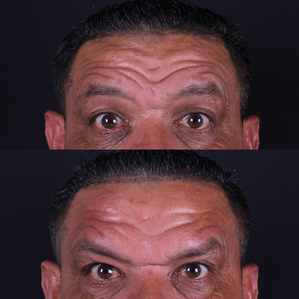 Foto 3 de Dra. Amanda Costa | Harmonização Orofacial