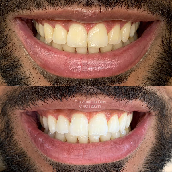 Foto 3 de Dra Amanda Dias | Dentista Ortodontista