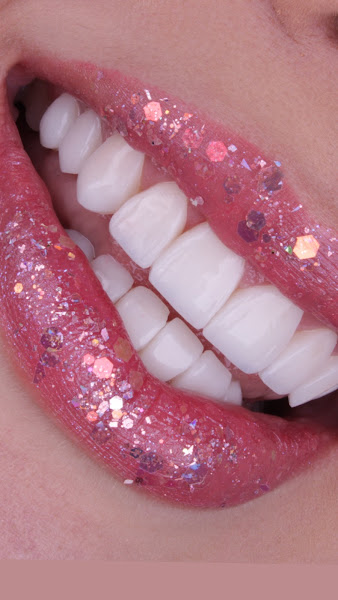 Foto 3 de Dra. Amanda Gomes | Lentes em porcelana e resina | Santana - São Paulo