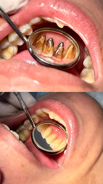 Foto 2 de Dra Amanda Kraft – Dentista em Piracicaba