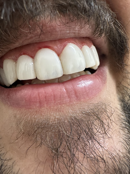 Foto 2 de Dra. Amanda Madona - Odontologia Estética