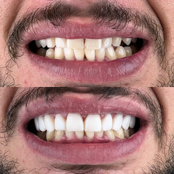 Foto 3 de Dra. Amanda Madona - Odontologia Estética