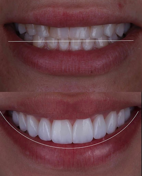 Foto 2 de Dra Amanda Medeiros | Lentes Dentárias | Implantes | Aparelhos Invisíveis | Zona Norte - SP