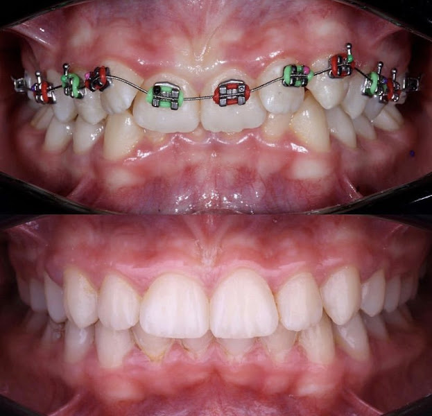 Foto 3 de Dra Amanda Medeiros | Lentes Dentárias | Implantes | Aparelhos Invisíveis | Zona Norte - SP