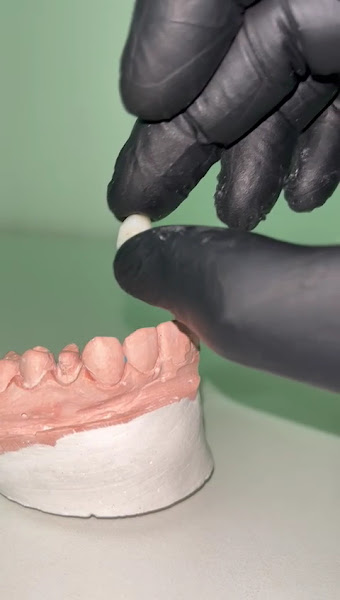 Foto 4 de Dra Amanda Medeiros | Lentes Dentárias | Implantes | Aparelhos Invisíveis | Zona Norte - SP