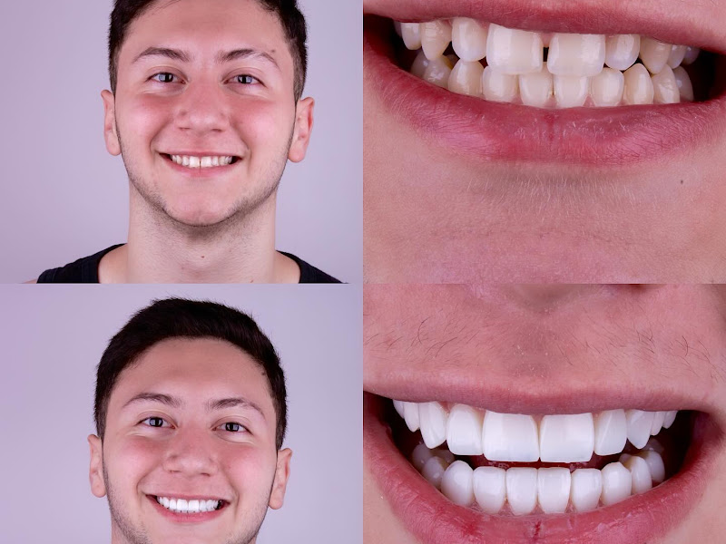 Foto 8 de Dra Amanda Medeiros | Lentes Dentárias | Implantes | Aparelhos Invisíveis | Zona Norte - SP