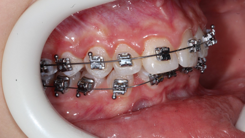 Foto 2 de Dra Amanda Pimentel, Ortodontista