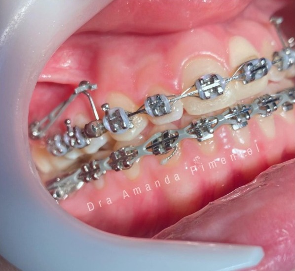 Foto 3 de Dra Amanda Pimentel, Ortodontista