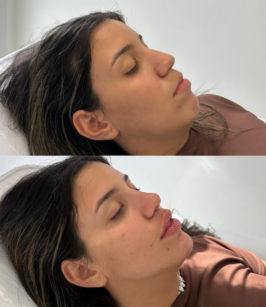 Foto 3 de Dra. Amanda Rocha | Harmonização Facial - São Gonçalo