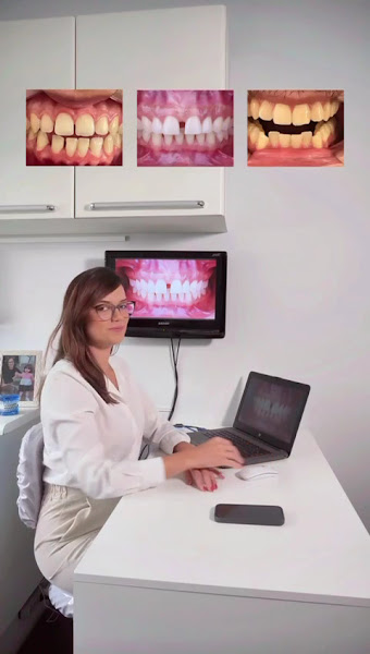 Foto 3 de Dra Amanda Silva | Alinhadores Invisíveis SouSmile | Dentista Itu