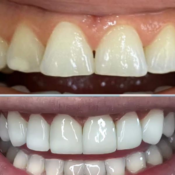 Foto 2 de Dra Ana Barros Odontologia e Estética