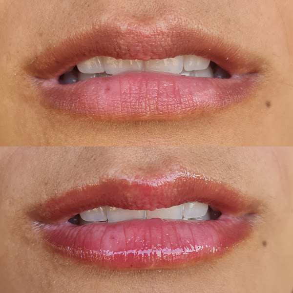 Foto 3 de Dra Ana Barros Odontologia e Estética