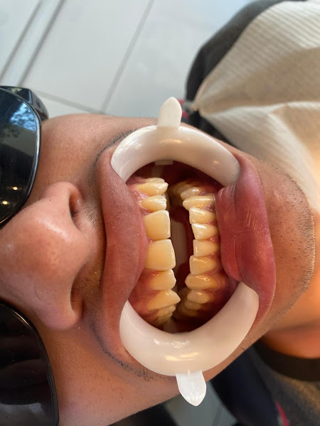 Foto 3 de Dra. Ana Beatriz - Cirurgiã Dentista