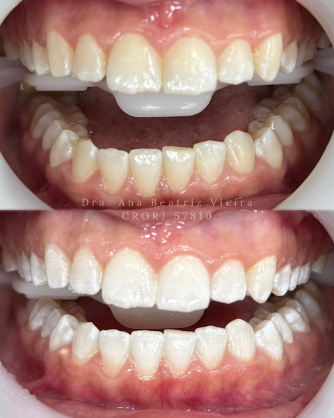 Foto 3 de Dra. Ana Beatriz Vieira | Dentista