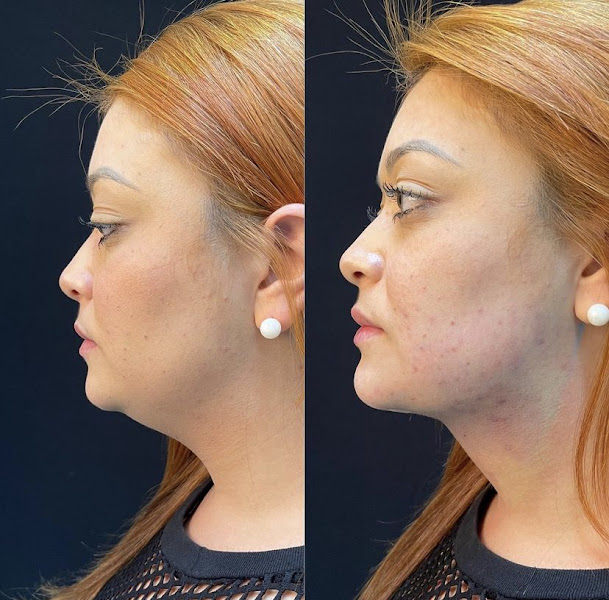 Foto 3 de Dra. Ana Carolina Castro