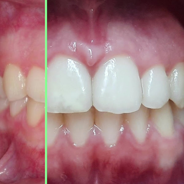 Foto 3 de Dra. Ana Carolina Orlanda Junqueira Defina | Ortodontista Ribeirão Preto