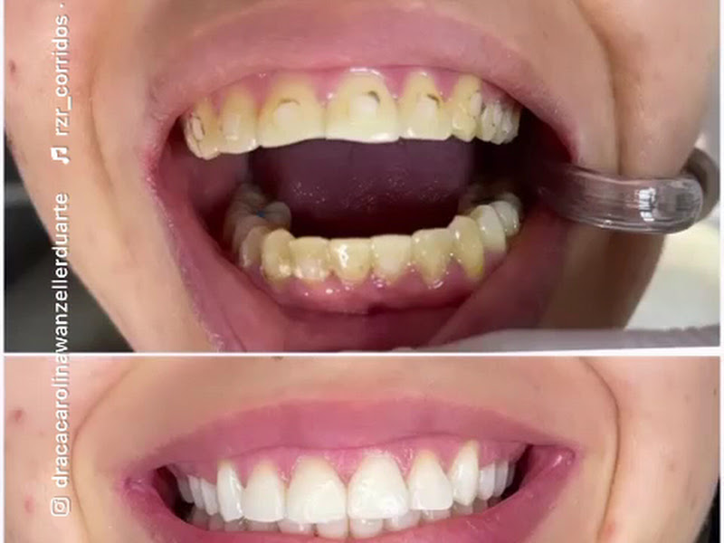 Foto 2 de Dra. Ana Carolina Santos- Implantodontia, Periodontia E Prótese
