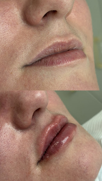 Foto 2 de Dra. Ana Carolina Vieira da Rosa - Cirurgiã-Dentista