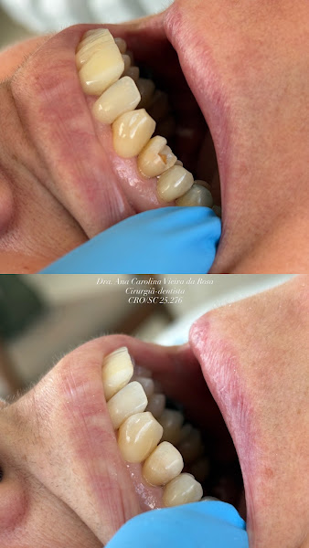 Foto 3 de Dra. Ana Carolina Vieira da Rosa - Cirurgiã-Dentista