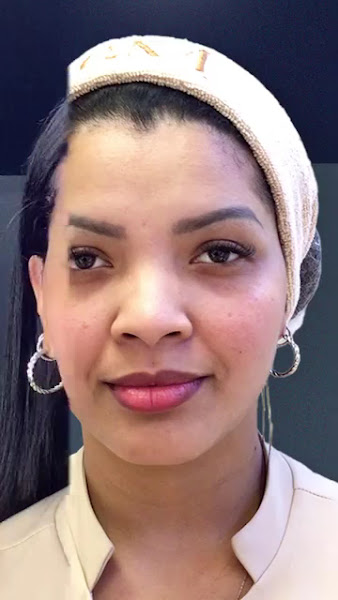 Foto 3 de Dra. Ana Carulina Moreno - Dermatologista Barra da Tijuca - RJ