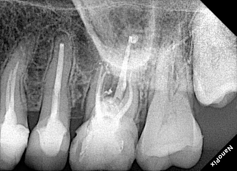 Foto 2 de Dra. Ana Célia Moura - Endodontia (Tratamento de canal) Especializada em Recife