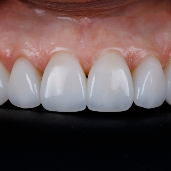 Foto 3 de Dra. Ana Cláudia Maione - Dentista Méier