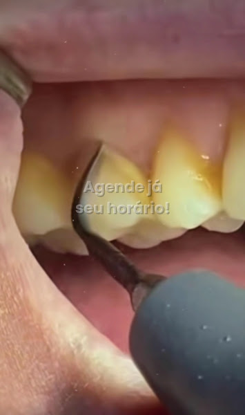 Foto 3 de Dra Ana Claudia Monteiro | Dentista | Casa Forte Recife