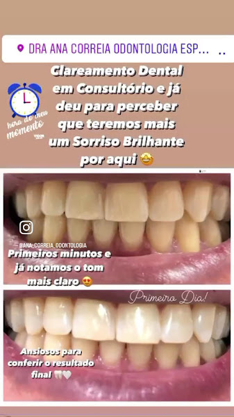 Foto 3 de Dra. Ana Correia Cirurgiã Dentista