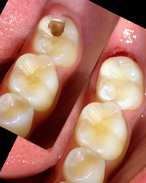 Foto 2 de Dra. Ana Cristina Matoso - Odontopediatria, Estética Dental e Laserterapia