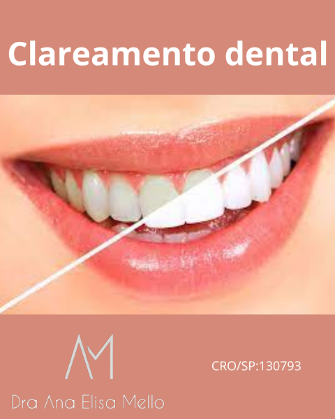 Foto 3 de Dra. Ana Elisa Mello - Dentista | CRO/SP:130793