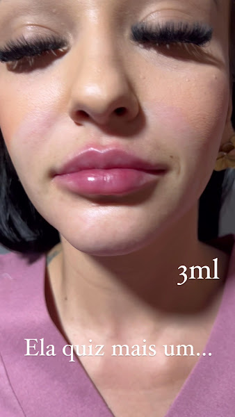 Foto 2 de Dra Ana Flávia Mendes ESTÉTICA AVANÇADA