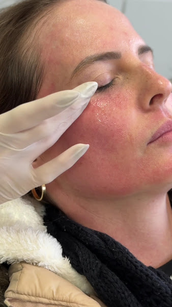 Foto 2 de Dra. Ana Julia Caetano - São José - Harmonização Facial