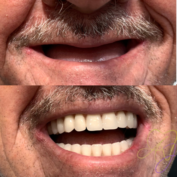 Foto 3 de Dra. Ana Júlia Carvalho (Dentista Sumaré - Urgências e Emergências 24 HORAS) SOMENTE PARTICULAR