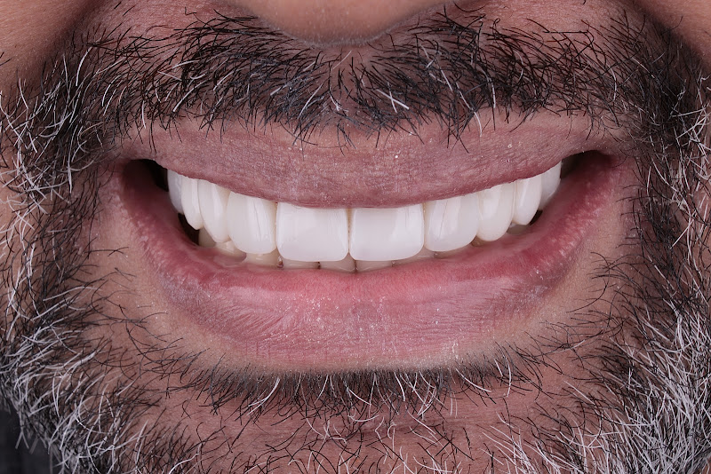 Foto 2 de Dra. Ana Karina de Azevedo - Odontologia