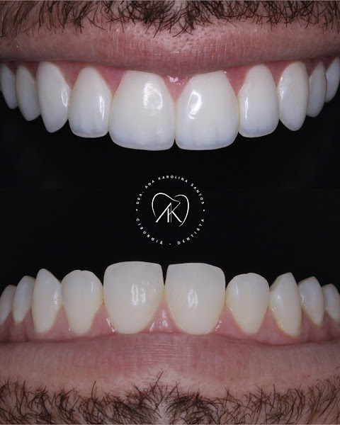 Foto 2 de Dra. Ana Karolina Santos | Odontologia Estética e Integrada